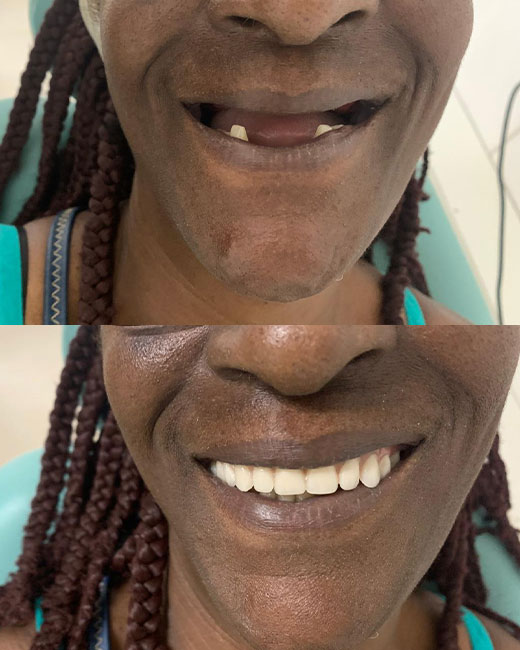 Casos-Antes-e-Depois1